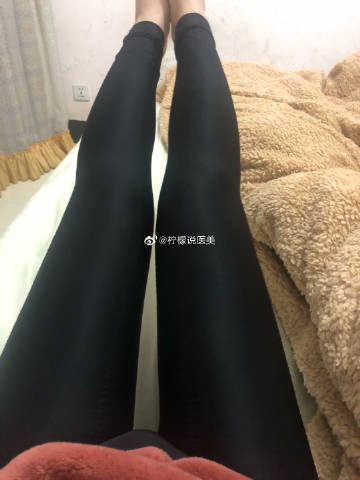 行情高台跳水增值税下调难除煤制乙二醇隐忧:ky开元集团(图4) ky开元